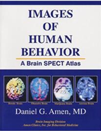 《人类行为的脑影像学SPECT图谱》
